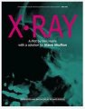 X-Ray by Ben Harris & Steve Shufton